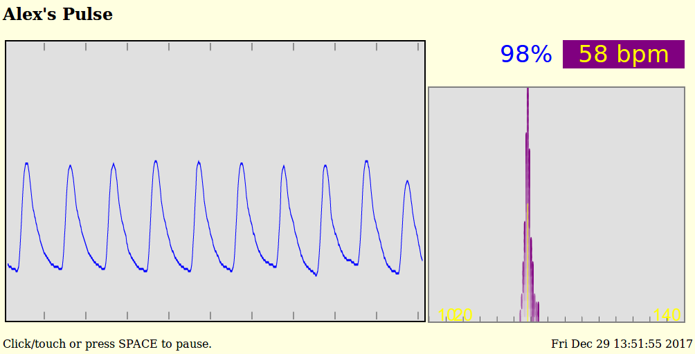 Normal heartbeat 12/29/2017 13:51:55